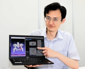 骨折を自動的に検知するシステムについて解説する小橋昌司教授=姫路市西駅前町 骨折を自動的に検知するシステムについて解説する小橋昌司教授=姫路市西駅前町