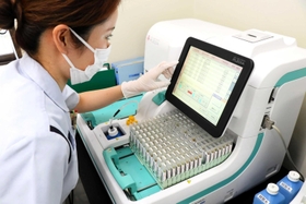 大腸がんの便潜血検査で検体を調べる機器=神戸市東灘区御影本町6 大腸がんの便潜血検査で検体を調べる機器=神戸市東灘区御影本町6