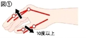 親指を含めた3本の指が10度以上伸ばせる(図1) 親指を含めた3本の指が10度以上伸ばせる(図1)