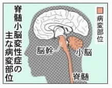 小脳 小脳