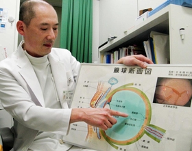 眼球の構造を示しながら糖尿病網膜症を説明する大原在元・眼科部長=ツカザキ病院 眼球の構造を示しながら糖尿病網膜症を説明する大原在元・眼科部長=ツカザキ病院