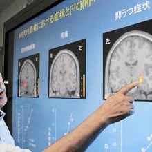 ○【慢性疲労症候群】写真①渡辺先生