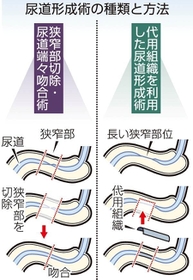 【図1】防衛医科大学校病院の堀口明男医師作成図を改編 【図1】防衛医科大学校病院の堀口明男医師作成図を改編
