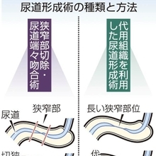図1【WEB用】種類と方法00002