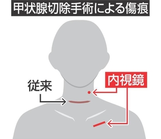 神戸新聞NEXT