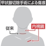 神戸新聞NEXT