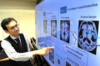 水頭症の判別技術などについて説明する県立大先端医療工学研究所の小橋昌司所長＝姫路市神屋町３