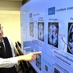 水頭症の判別技術などについて説明する県立大先端医療工学研究所の小橋昌司所長＝姫路市神屋町３
