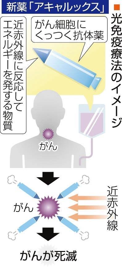 神戸新聞next 医療ニュース がん細胞を特殊な光でピンポイント攻撃 新薬承認