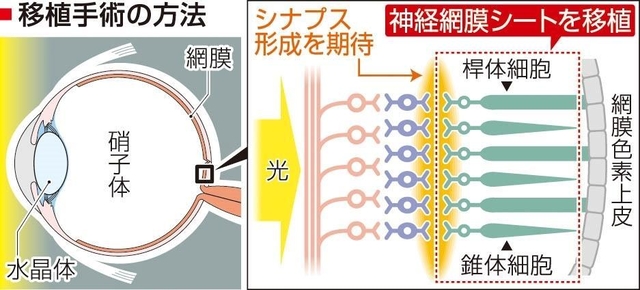 神戸新聞ＮＥＸＴ