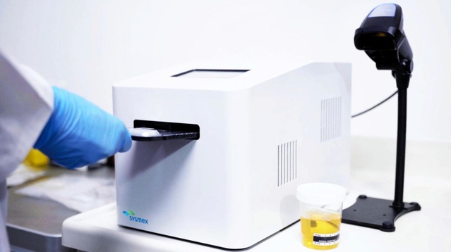 患者の尿から抗菌薬の有効性を調べる装置。欧州で発売した（シスメックス提供）