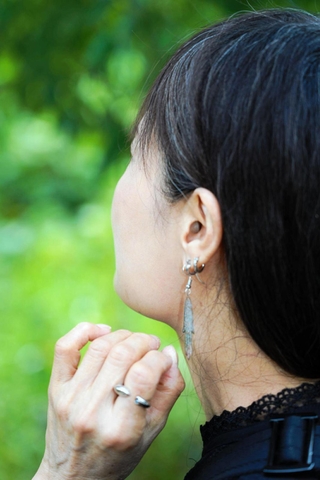いわゆる顔の「エラ」がコンプレックス。鏡を見るたび「なくなったらいいのに」と思っていた＝神戸市内 