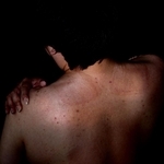 ２０年間、痛み止めの湿布薬を貼り続けた痕が肩から腰にかけて染みついている＝神戸市内