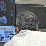 がん患者に病状や治療法を丁寧に説明する辻野佳世子放射線治療科長（右）＝明石市北王子町、がんセンター