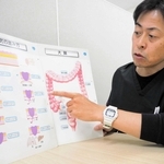 局所進行直腸がんと臨床試験が始まっている「ＴＮＴ治療」について説明する松田武医師＝神戸市中央区楠町７、神戸大病院