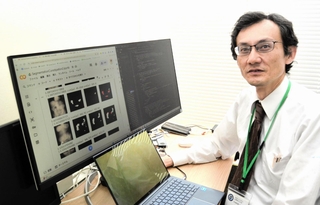 ＡＩを使って便秘の種類を判別する技術開発に取り組む兵庫県立大先端医療工学研究所の小橋昌司教授＝姫路市神屋町３