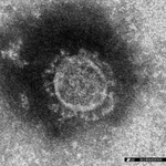 国立感染症研究所で分離された新型コロナウイルスの電子顕微鏡写真像（同研究所提供）