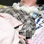 自宅療養で常時呼吸管理を要する障害者。家族全員が感染への不安に包まれる＝神戸市内（家族提供）