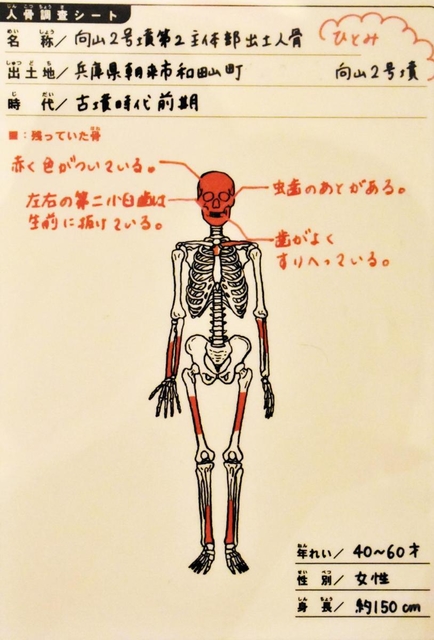 「ひとみ」さんの骨の特徴を記したシート＝兵庫県播磨町大中１