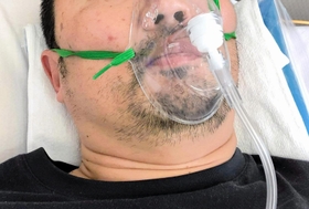 コロナに感染し、入院療養する男性。短期間で症状が悪化し、酸素吸入などで命をつないだ（男性提供）