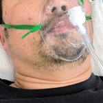 コロナに感染し、入院療養する男性。短期間で症状が悪化し、酸素吸入などで命をつないだ（男性提供）