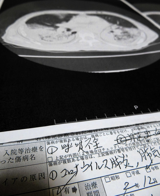 コロナウイルス肺炎などと書かれた診断書と、胸部のＣＴ画像のコピー