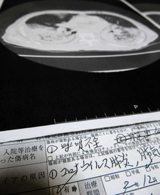 コロナウイルス肺炎などと書かれた診断書と、胸部のＣＴ画像のコピー