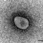 国立感染症研究所が分離した、新型コロナウイルスのオミクロン株の電子顕微鏡写真（同研究所提供）