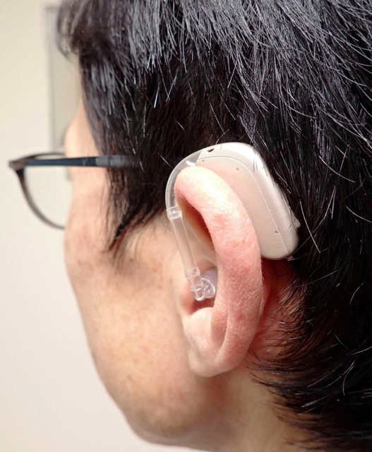 汎用（はんよう）性が高い耳掛け型補聴器