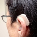 汎用（はんよう）性が高い耳掛け型補聴器