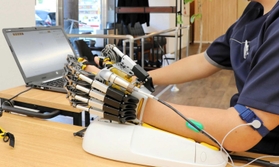 「ハンド・オブ・ホープ」と呼ばれる最新のリハビリ器具。まひが残る指先の屈曲を練習する＝宝塚市高司