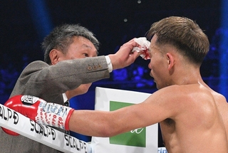 ＷＢＡバンタム級王座戦で、医師から右目上の傷のチェックを受ける王者の堤聖也（右）＝２月２４日、有明アリーナ