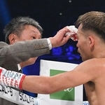 ＷＢＡバンタム級王座戦で、医師から右目上の傷のチェックを受ける王者の堤聖也（右）＝２月２４日、有明アリーナ