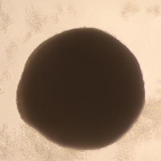 　ｉＰＳ細胞からつくったネフロン癆の病態を再現したミニ腎臓（東京科学大提供）