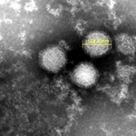 　「重症熱性血小板減少症候群」を引き起こすウイルスの電子顕微鏡写真（国立健康危機管理研究機構提供）