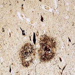 　脳の中にたまった「アミロイドベータ」（中央の二つのだ円形部分）（東京大薬学部提供）