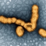 　インフルエンザウイルスの電子顕微鏡写真（米国立アレルギー感染症研究所提供）