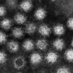 　ノロウイルス（大阪大提供）