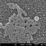 　百日ぜき菌の電子顕微鏡画像（国立健康危機管理研究機構提供）
