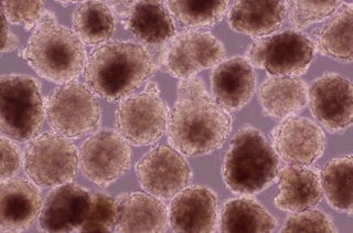 　ｉＰＳ細胞で作った心臓の筋肉の細胞を塊にした「心筋球」（ハートシード提供）