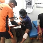 　南シナ海で負傷し、手当てを受けるフィリピン漁船の漁師＝１３日（フィリピン沿岸警備隊提供・ＡＰ＝共同）