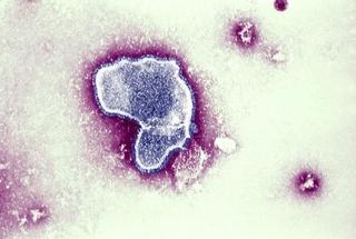 　ＲＳウイルスの電子顕微鏡写真（ゲッティ＝共同）