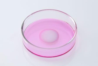 　患者の膝の軟骨細胞を培養して移植する再生医療等製品「ジャック」（ジャパン・ティッシュエンジニアリング提供）