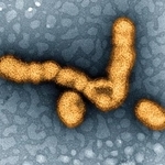 　インフルエンザウイルスの電子顕微鏡写真（米国立アレルギー感染症研究所提供）