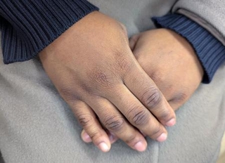 　取材に応じるナイジェリア出身のエマさん（仮名）＝１月２３日