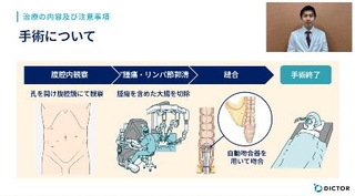 　アプリ「あなたの手術手帳」の画面（名古屋市立大病院提供）
