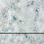 　未治療の肺線維症のマウスで老化細胞（青色）が存在する様子（上）と、ナトリン３ｂを投与し老化細胞（青色）が減少した様子（京都大近藤祥司准教授提供）