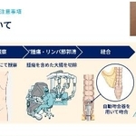 　アプリ「あなたの手術手帳」の画面（名古屋市立大病院提供）