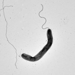 　コレラ菌の電子顕微鏡写真（許駿琉球大助教提供）