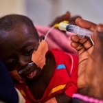 　１５日、スーダン北東部ポートスーダンで、母親から粉ミルクを与えられる栄養失調の幼児（ＡＰ＝共同）